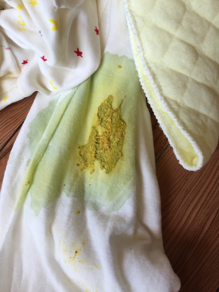 我儿子出生第五天了,前几天便便是黄色的,今天拉便便居然是黄绿色的