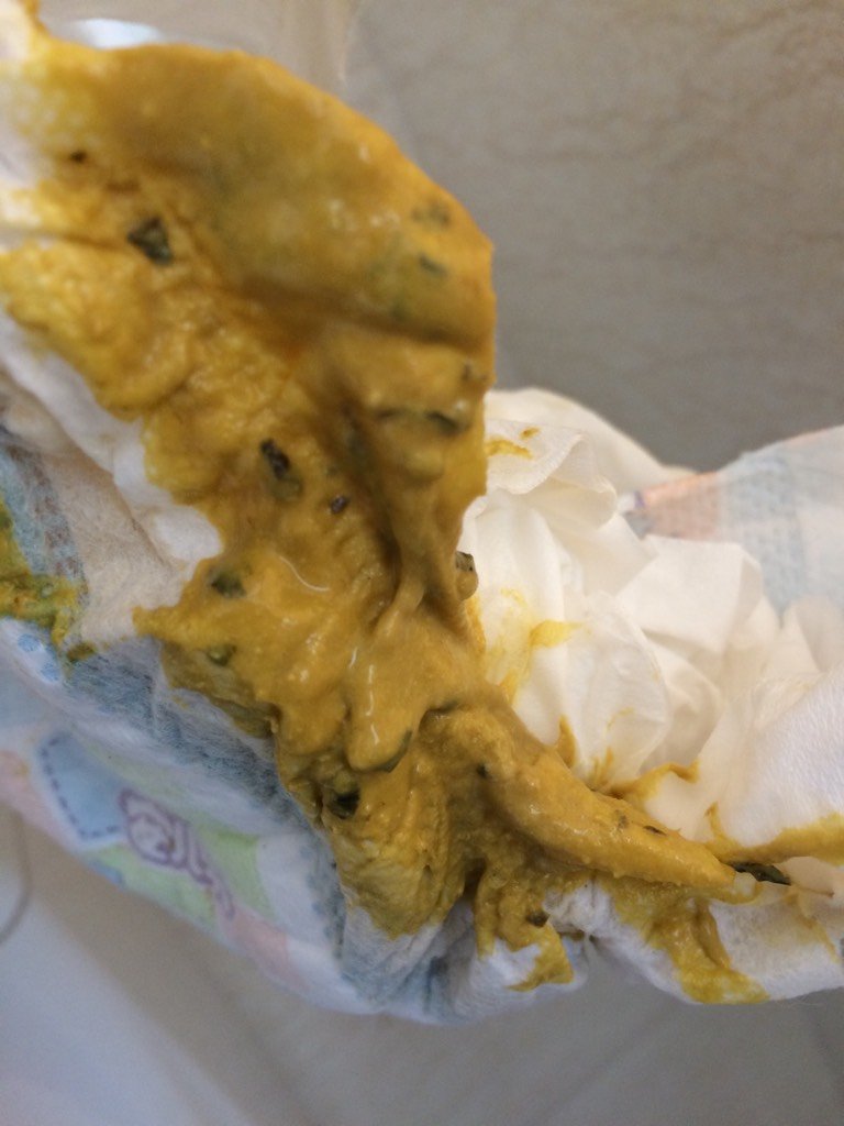 现在喝奶粉了每天拉大便,稀的,正常吗,绿色的是菜叶,宝宝现在八个月
