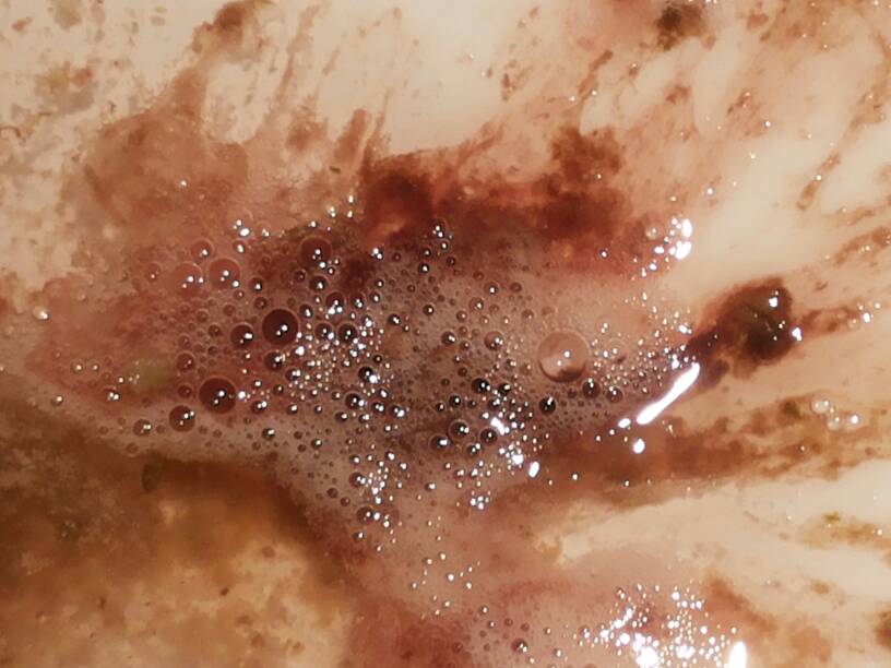 褐色胃液图片图片