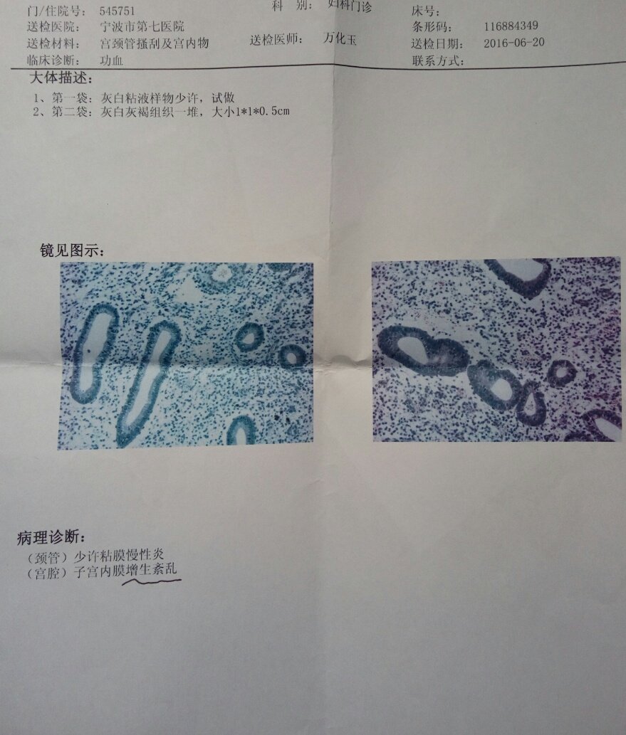 我是86年出生的,今年刚满30周岁现在查出子宫内膜增生紊乱,心里很担心