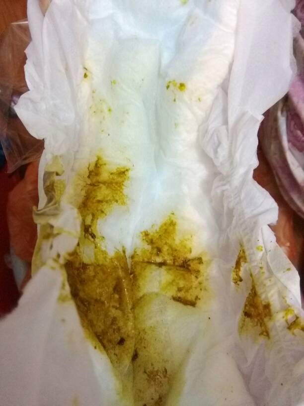 出生33天宝宝有点黄疸,吃的茵栀黄口服液,这两天拉的大便颜色有点深