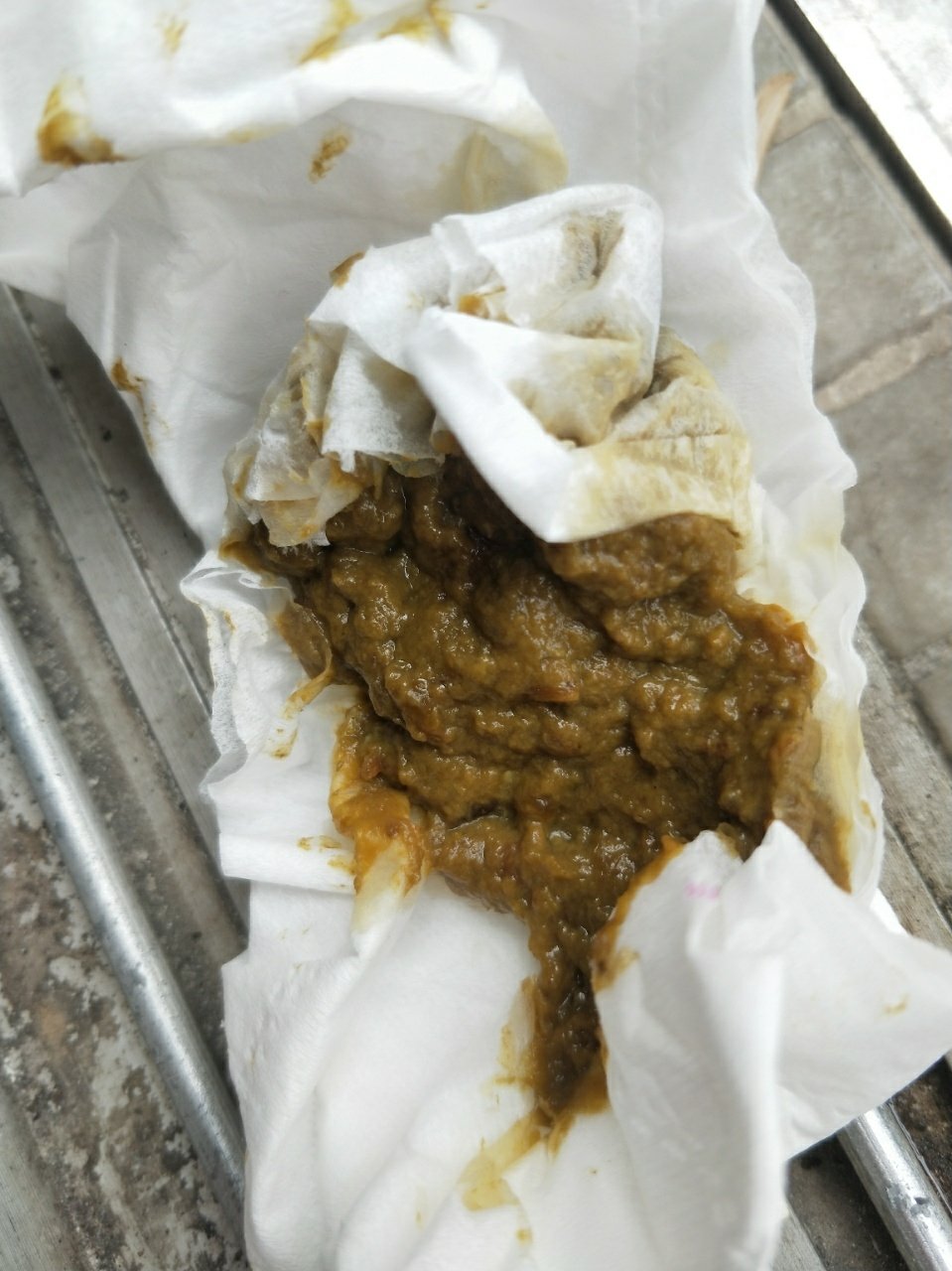 4楼 宝宝不知道怎么拉稀了怎么办?