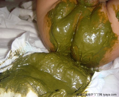 平时放屁很臭,便便酸臭味重