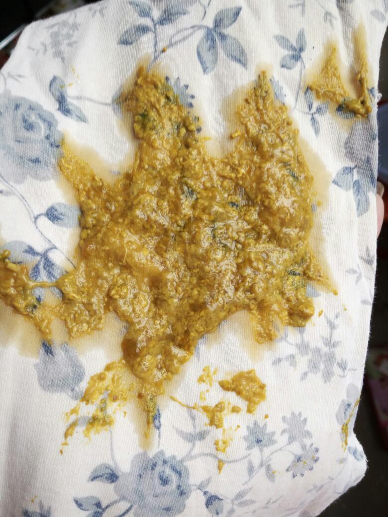 宝宝大便正常吗？