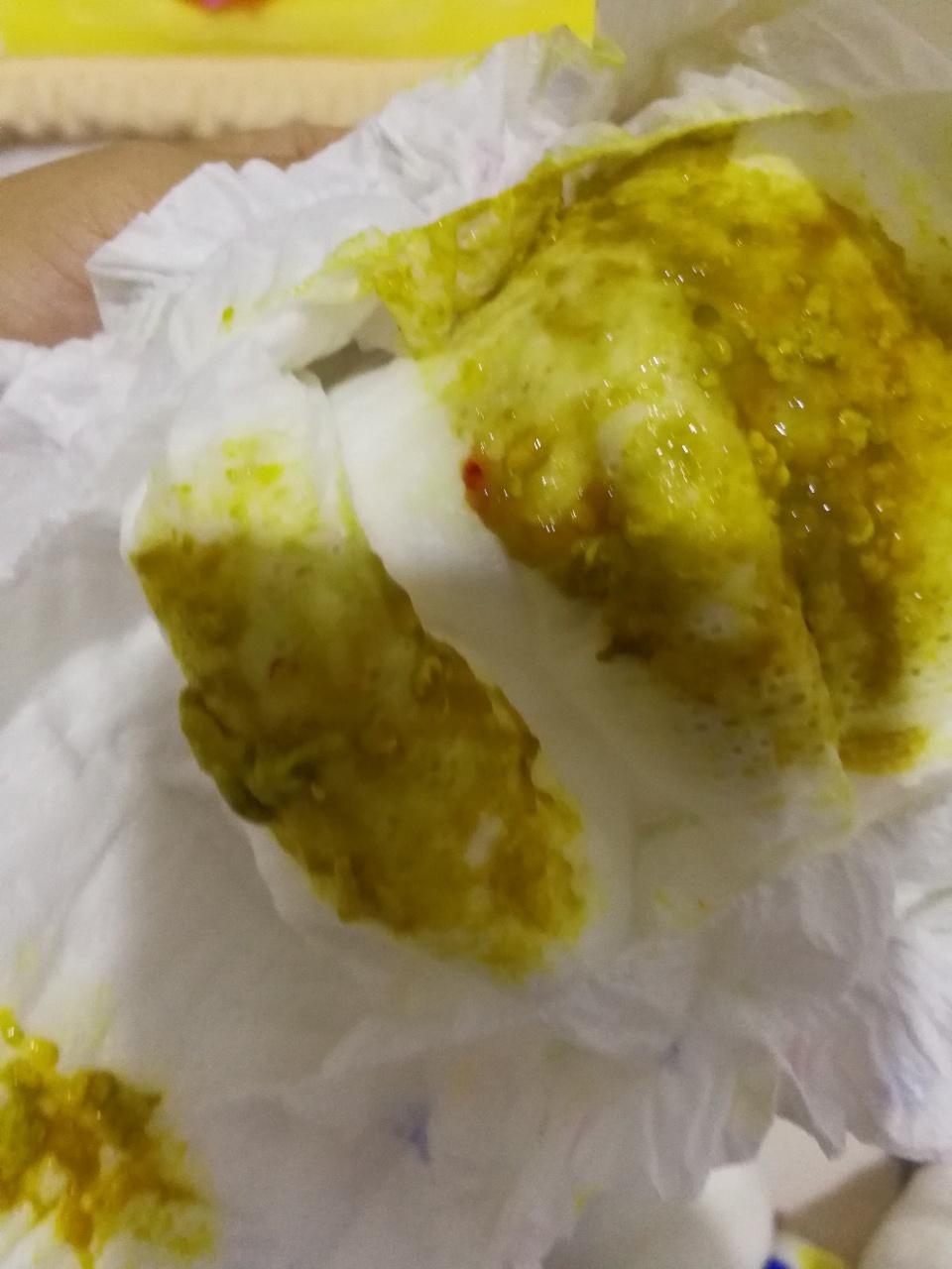 刚满月宝宝大便有红点,是什么原因?