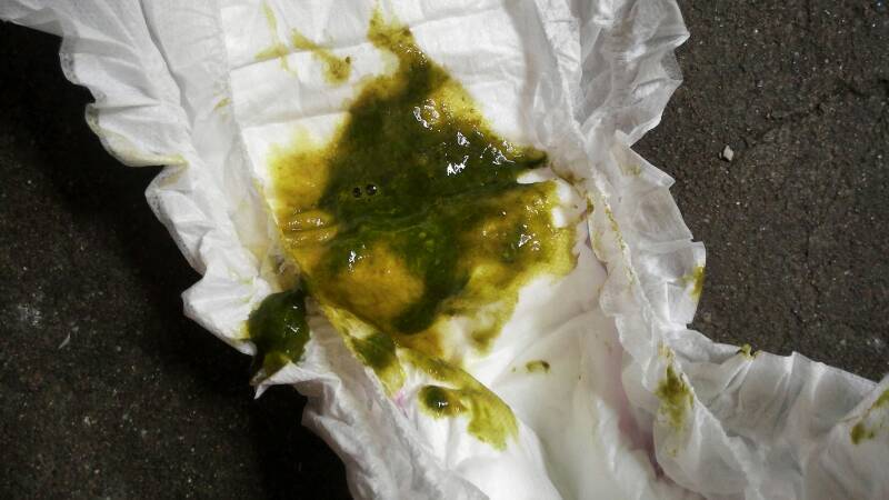 宝宝大便是绿色的 还拉肚子?怎么办?