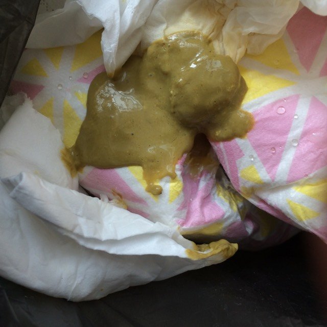 宝宝现在8月23天了 从来没拉过干大便 都是稀薄样 一天两到三次正常吗