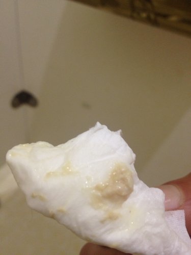 有白带豆腐渣样的 有10天了 有用妇炎康 没有异味