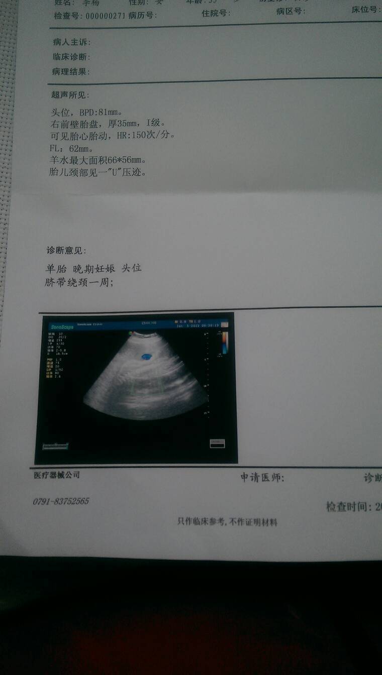 怀孕31周来零3天,拍了一张彩超,医生说宝宝比较大,让我少吃点,另外