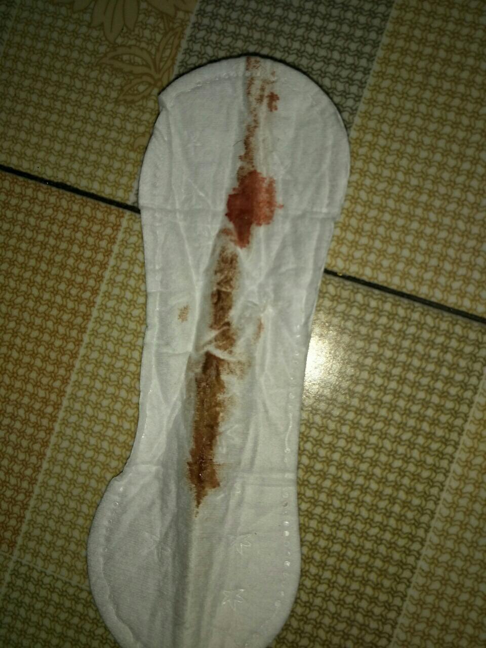 产后4个多月白带是褐色的有时还有血是怎么回事