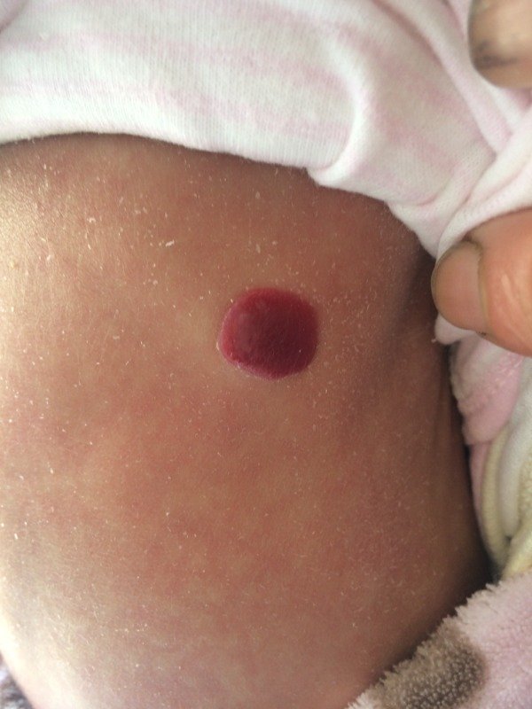 怎么回事啊? - 百度宝宝知道