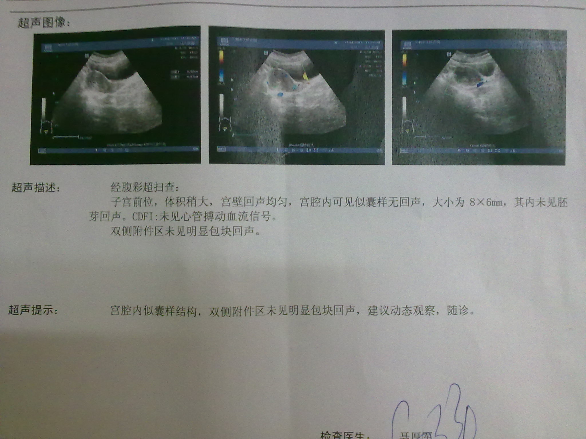 孕妇肚子图片素材-编号37135086-图行天下