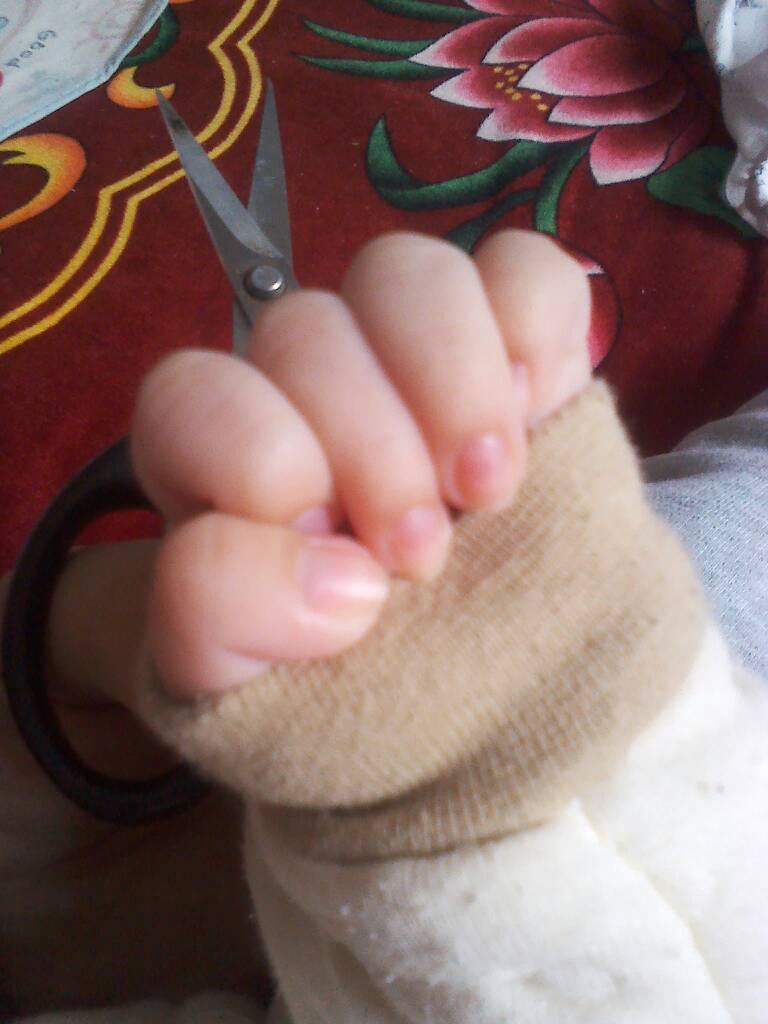 婴儿指甲颜色正常不