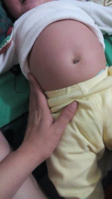 我女儿肚子怎么像皮球一样鼓鼓的