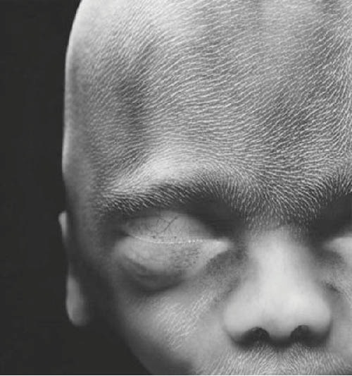 称作胎毛的细绒毛布满了整个脑袋.