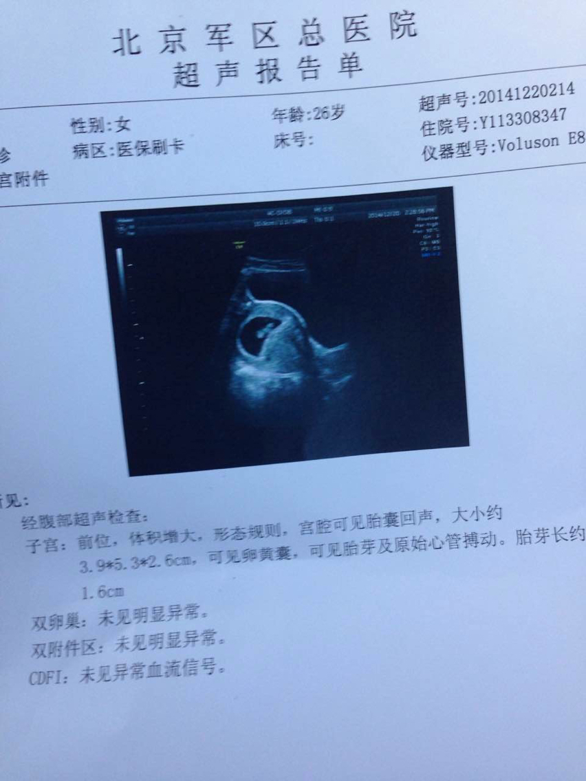 怀孕53天的胎儿图片图片