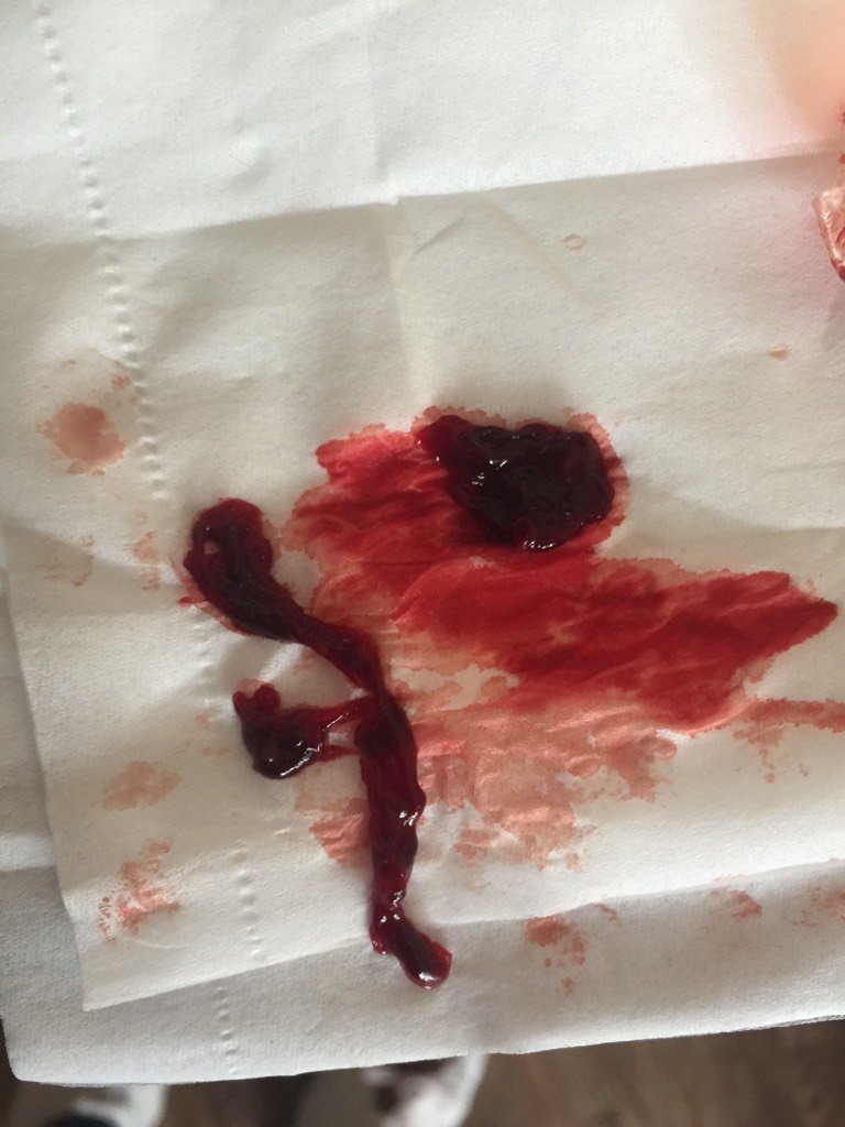 19号月经来的,这个月准备要宝宝,试纸试过没有,19号也就是前天流血了