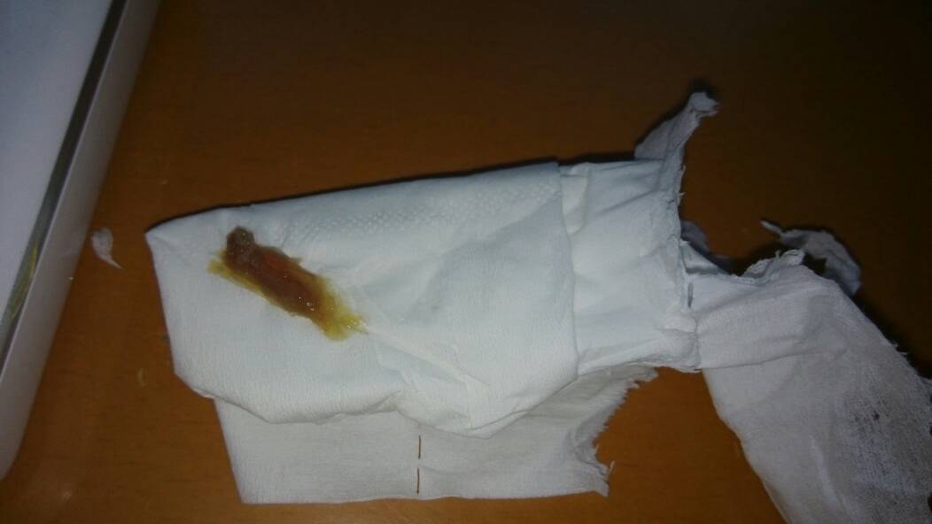 白带红色是咱们回事?以前也有这种情况,但是没有这次这么红