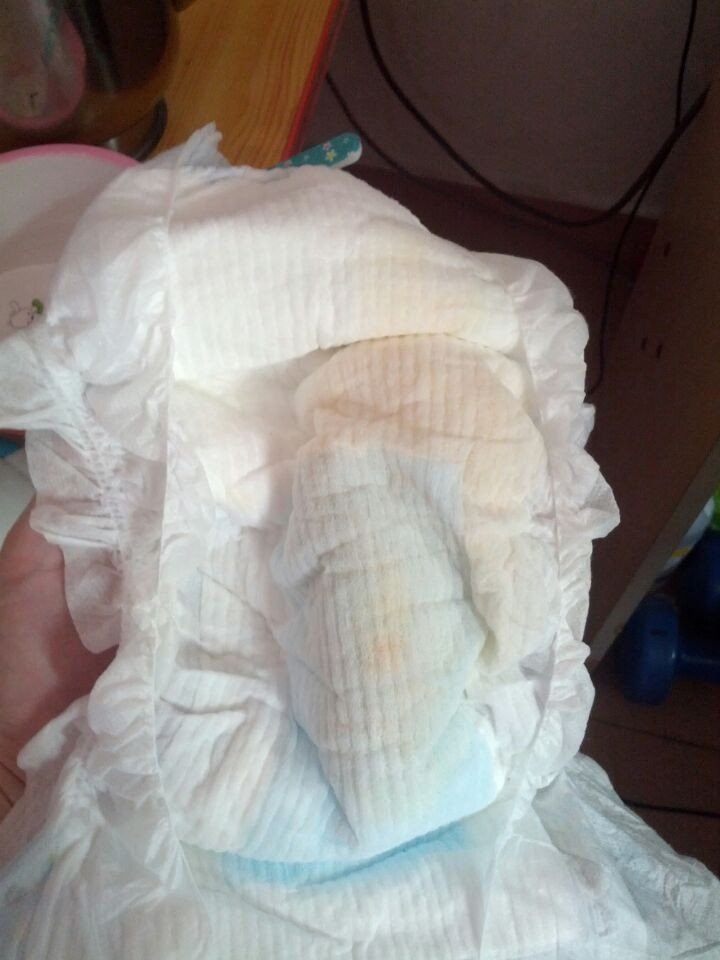 你好医生,我的小孩5个多月了,这两天尿黄又少,今天早上起来喝了牛奶隔