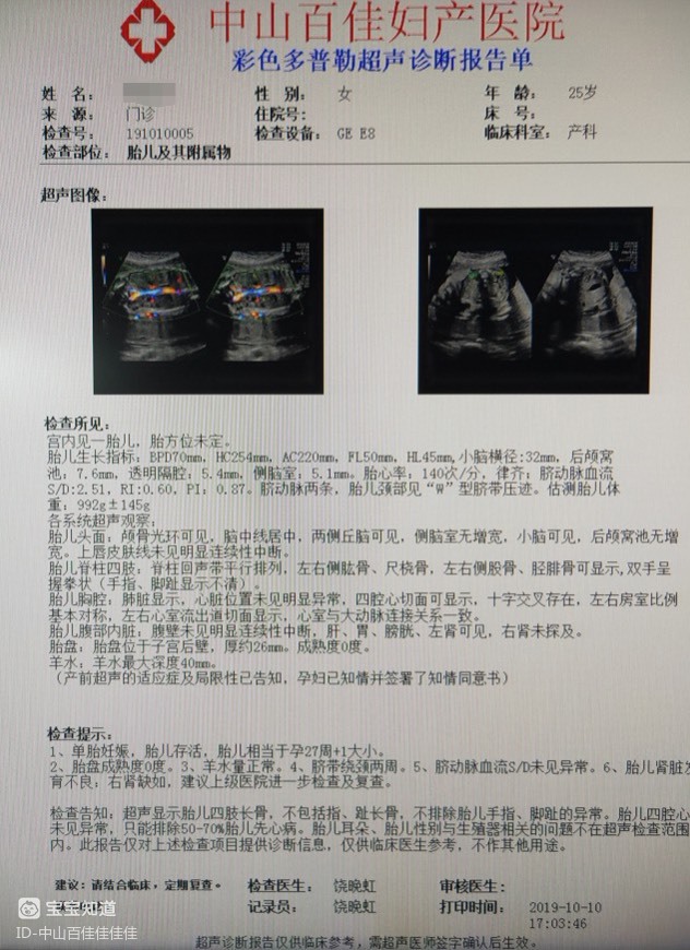 超声科饶晚虹主任实例解读胎儿肾缺如