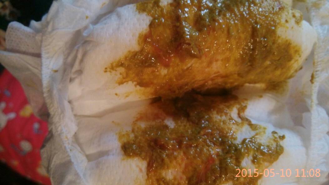 吃着消炎药了宝宝大便怎么还有血丝,这红血丝是怎么回事?