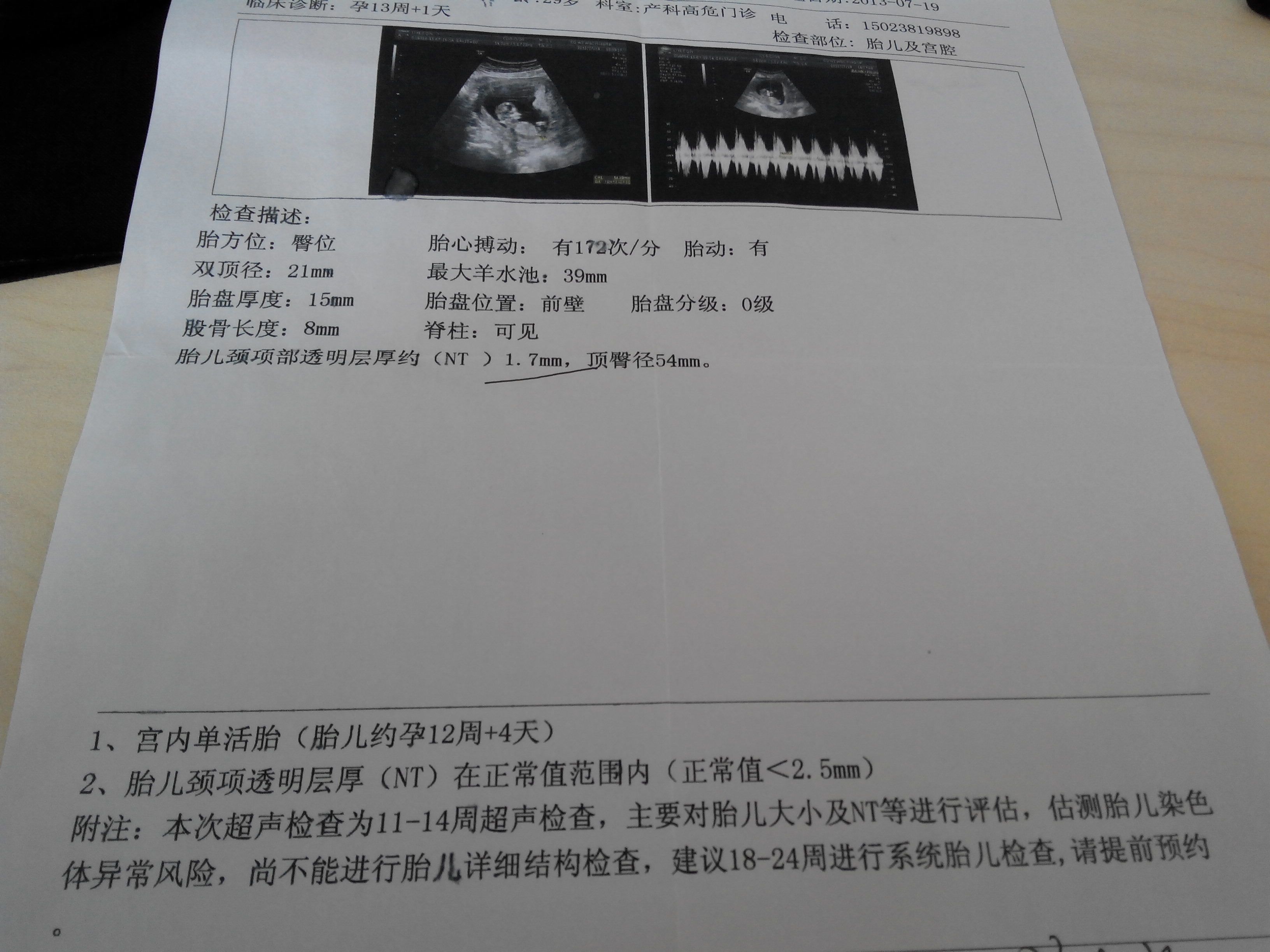 这是我怀孕15周的唐氏征产前筛查报告单，请医生帮我看看正常吗？ - 百度宝宝知道
