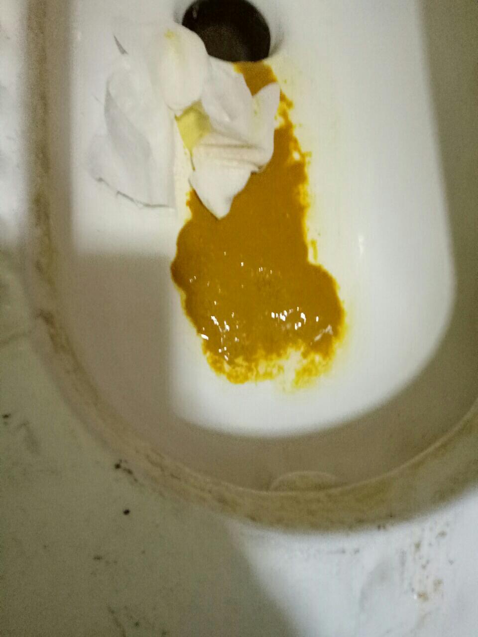 三个月的宝宝便秘,放屁臭怎么办?求回答