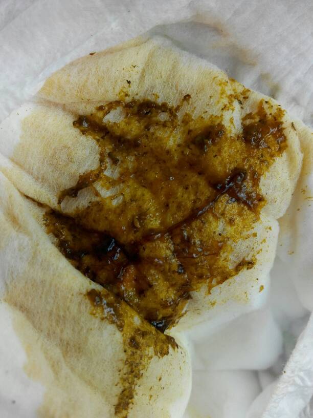 问答 问答首页  为您推荐: 其他回答 宝宝这种大便是不正常的,宝宝