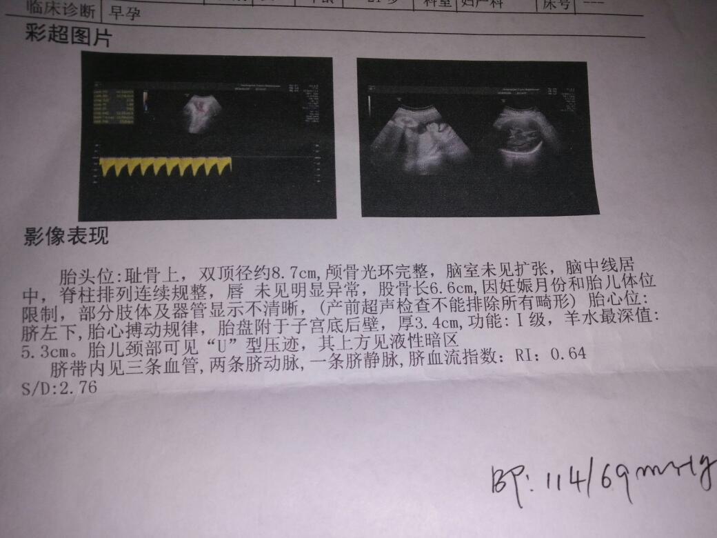 我想要男孩，你们在b超单子上看出来是男孩吗？