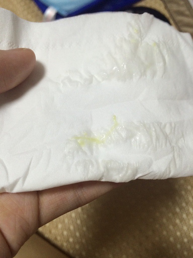 怀孕5个月下体会排出谈绿色的排泄物怎么回事 跟白带一样的正常排出来