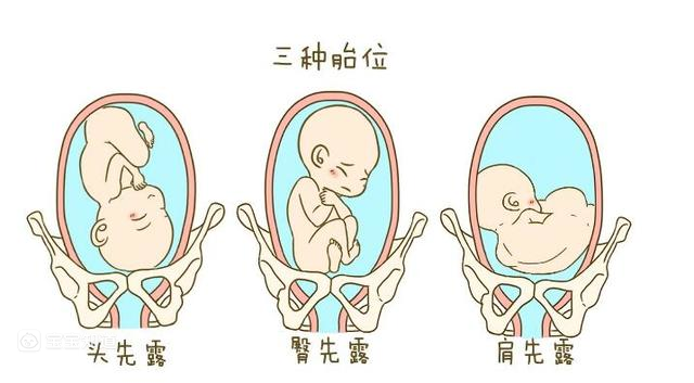 胎儿在子宫中到底有多少姿势