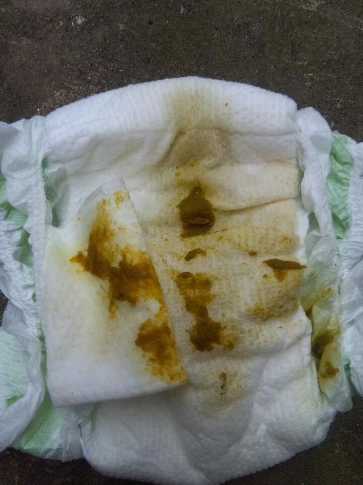 宝宝半岁了,拉胡豆煮熟了返沙那样的便便是为什么?