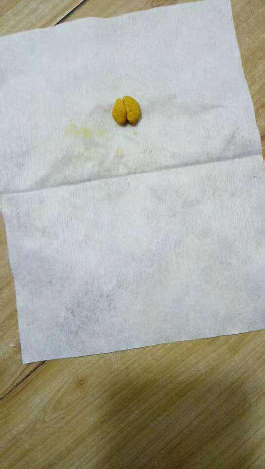 紧急!请问一下宝宝拉这种屎,肚脐这样脱落有什么吗