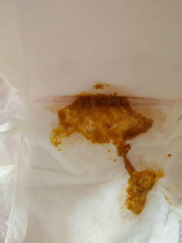 了 弘毅宝    2015-05-09 13:05 刚刚是老公回复的,那有黄胆很正常,没