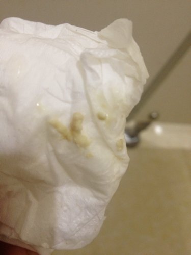 有白带豆腐渣样的 有10天了 有用妇炎康 没有异味