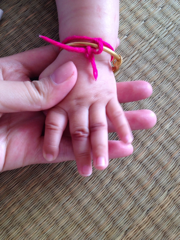 请问宝宝手指关节处发紫是怎么回事啊?