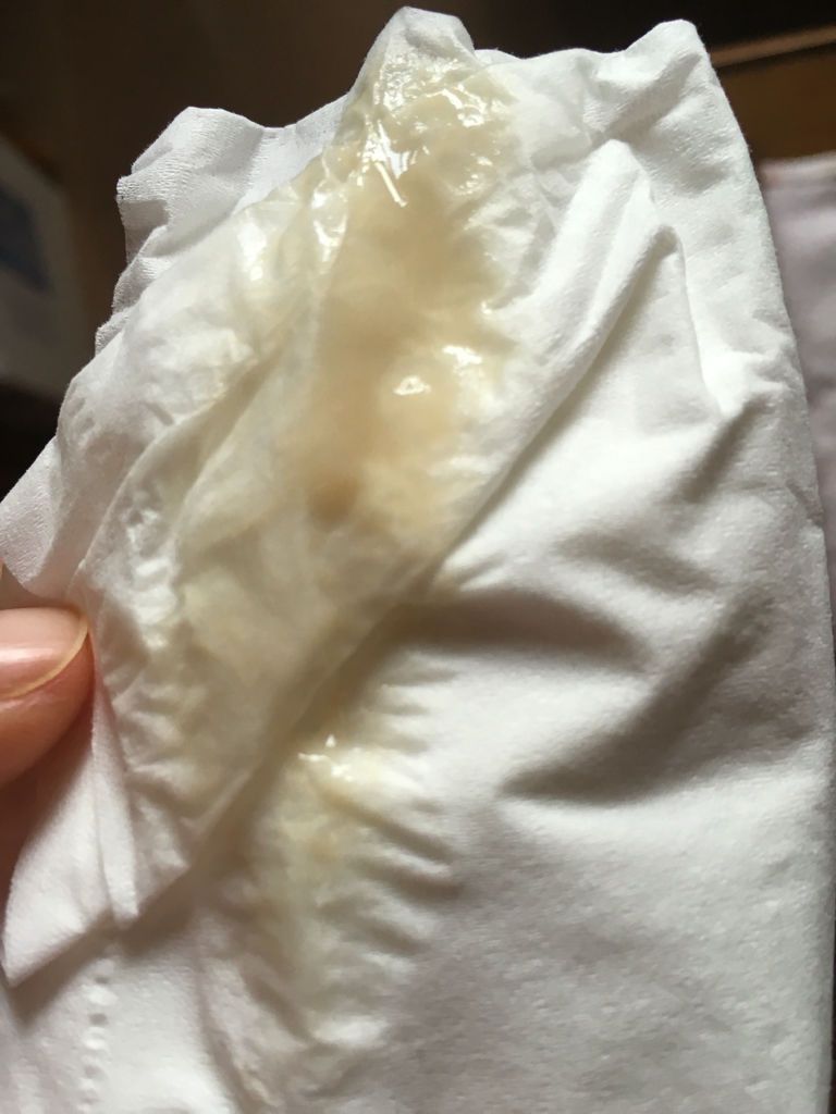 月经一直不正常,这个月又17 天没来啦!