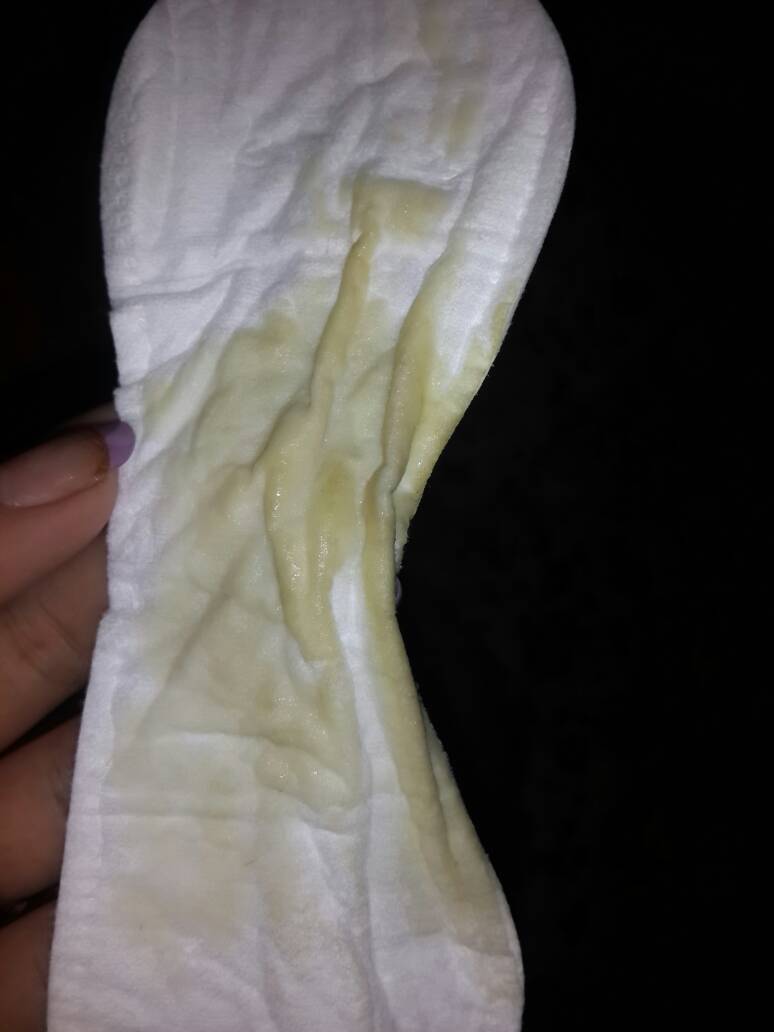 都会有这个液体流出来,从30号月经完了到现在都有,每天下面都会有怪味