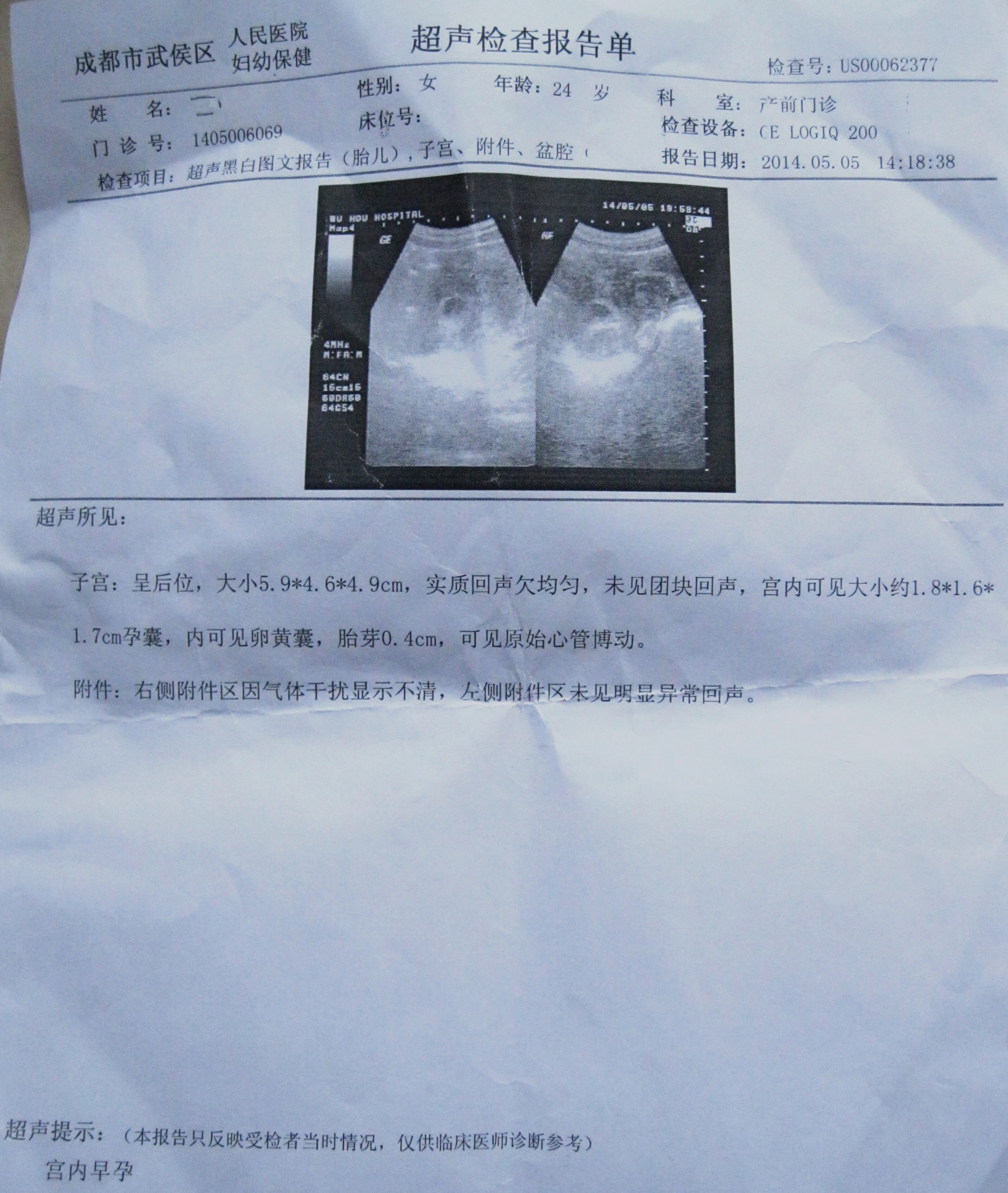 怀孕超声检查报告!