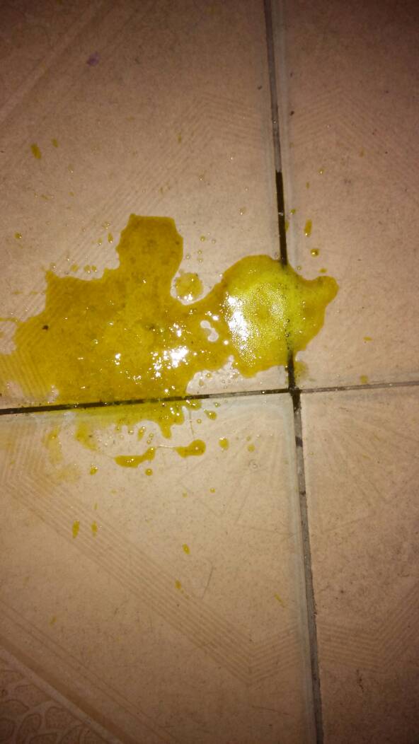 宝宝四个半月,这几天拉大便次数增多,而且颜色是这样的,孩子是怎么