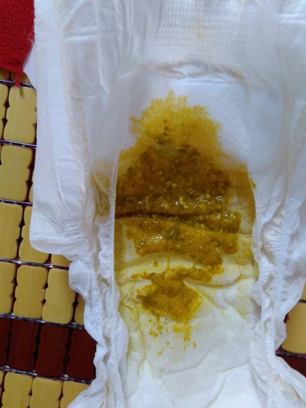 宝宝便便这样的怎么回事,还有泡泡?