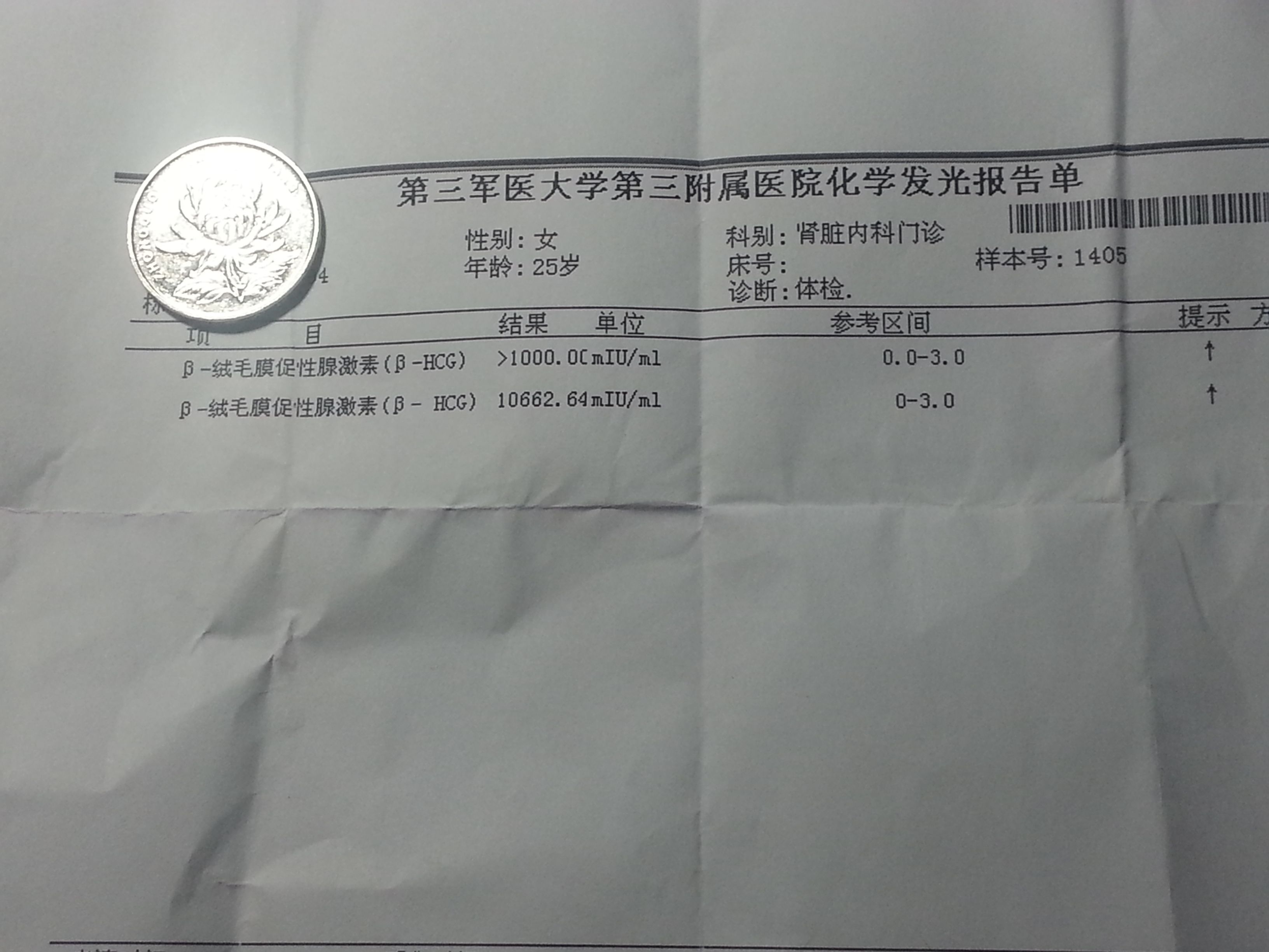 β-hcg绒毛膜促性腺激素正常吗?