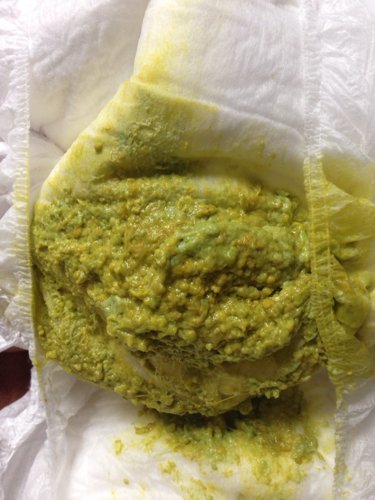 里面全是白色颗粒 今天拉的是黄中有绿色的大便 - 百度宝宝知道