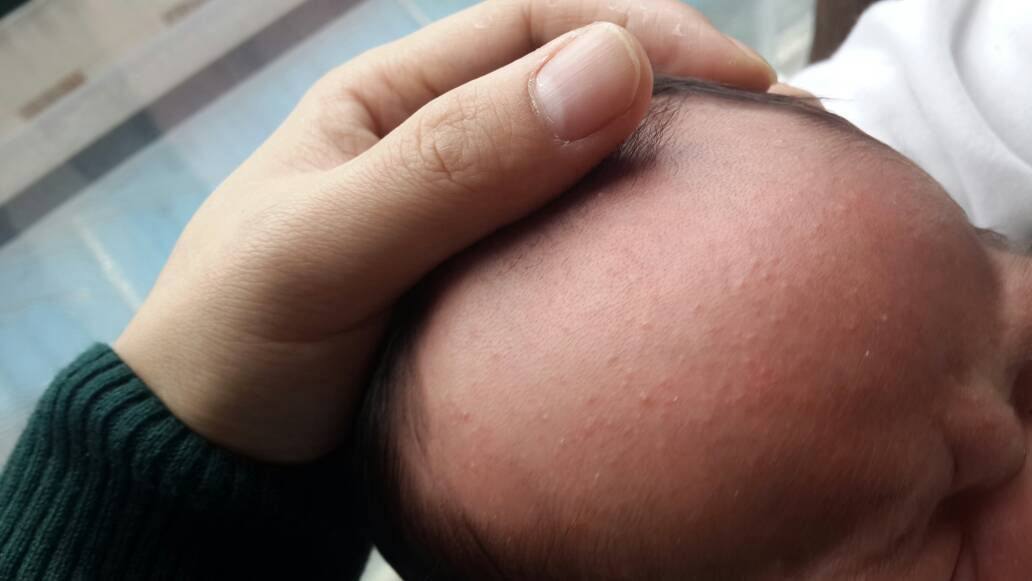 刚刚揭开宝宝帽子突然发现出现劫这么多!