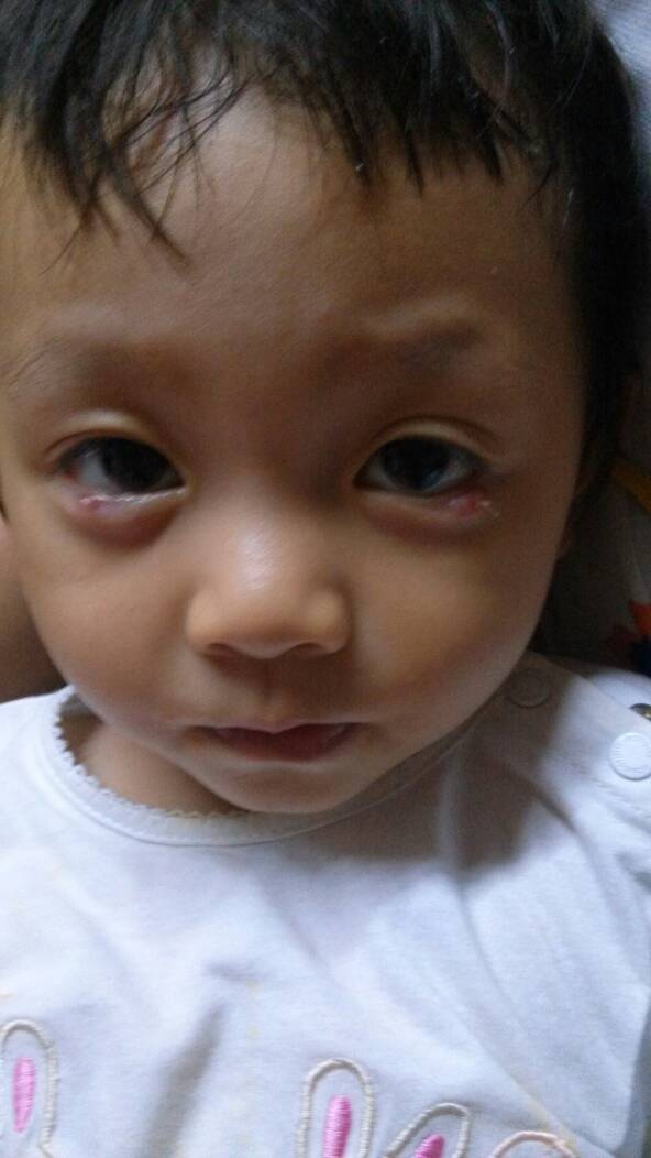 看看我女儿是怎么了