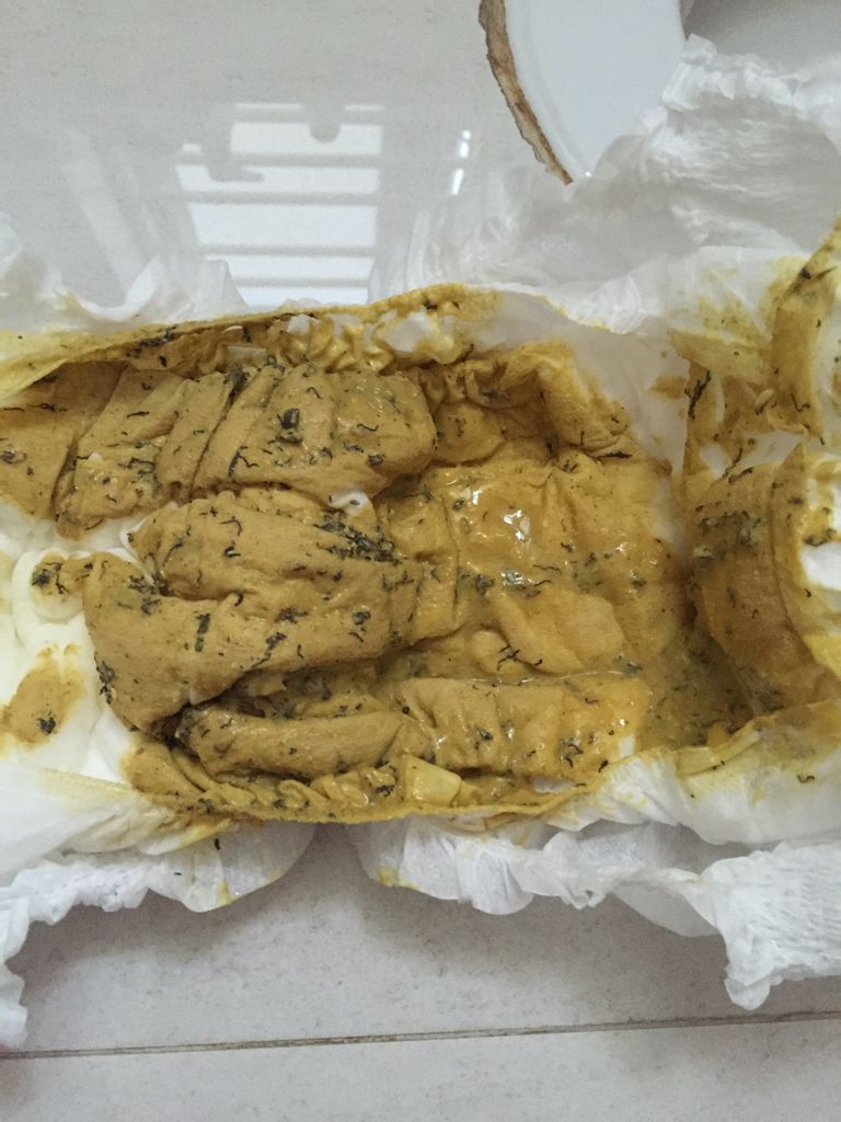 请问拉这样的粑粑是怎么回事,像虫子一样的,急急急 - 百度宝宝知道