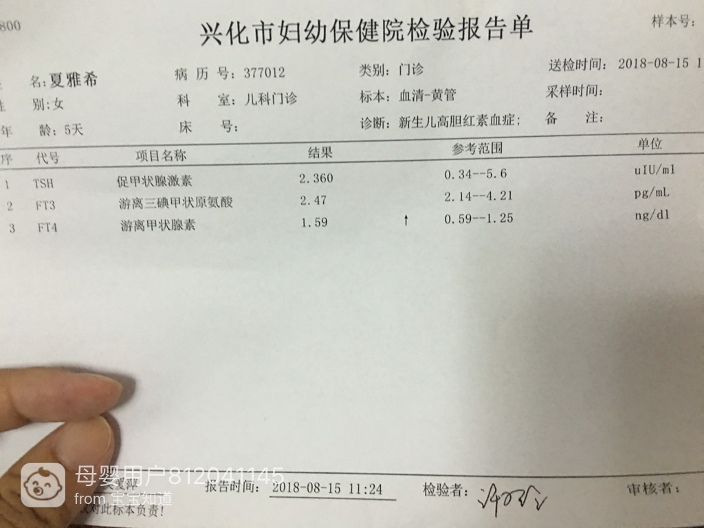 新生儿游离甲状腺素ft4偏高一点