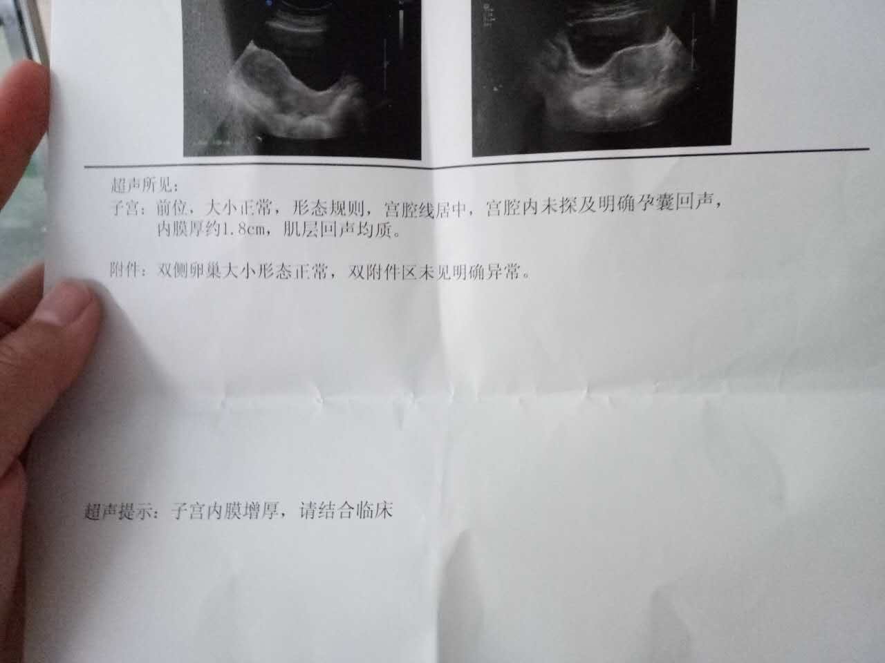 从彩超中可以看出怀孕吗?