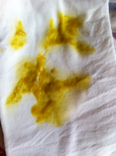 属于脱水吗?母乳喂养,四个月宝宝,还带点奶瓣