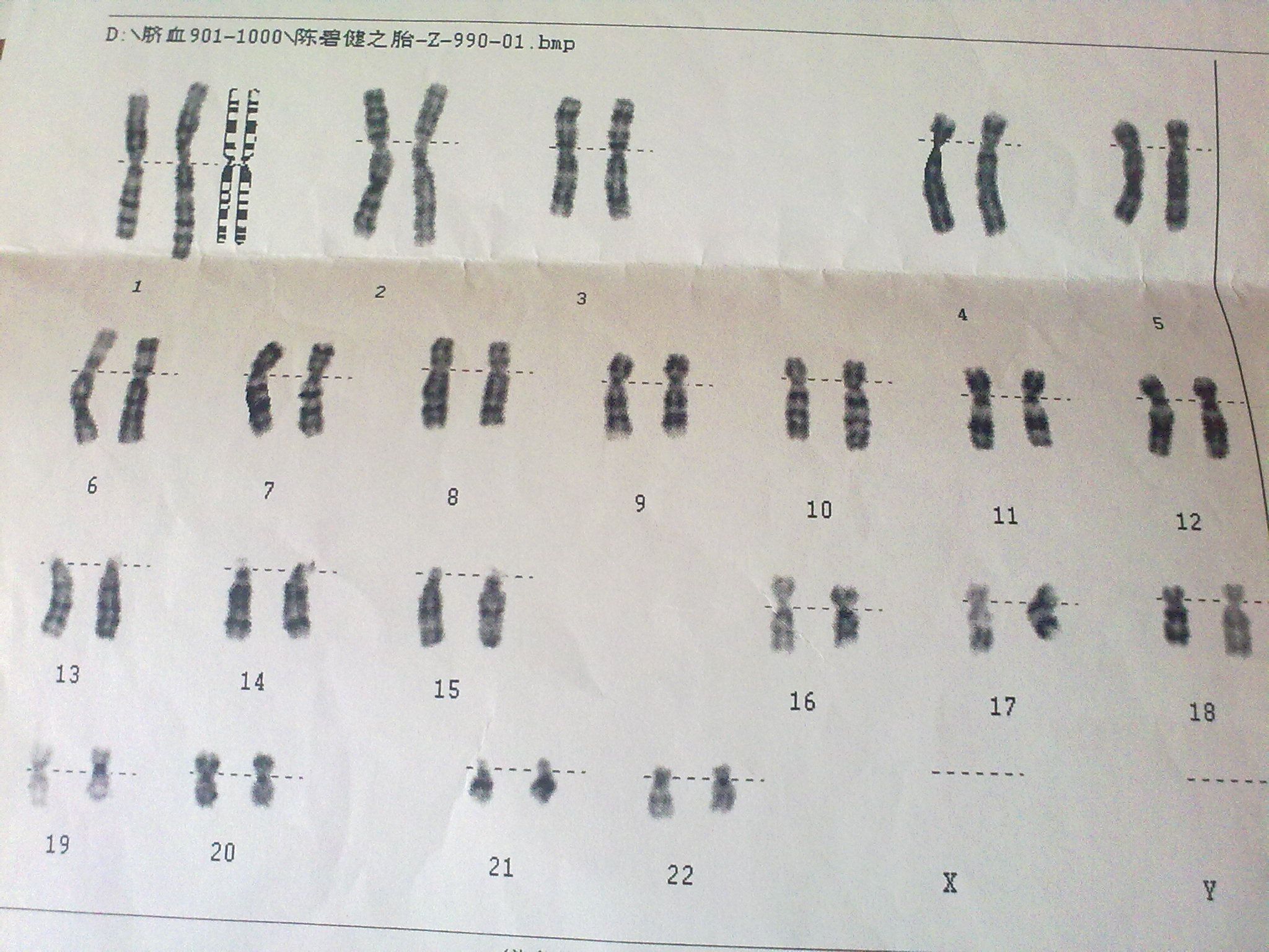 胚胎染色体报告图片
